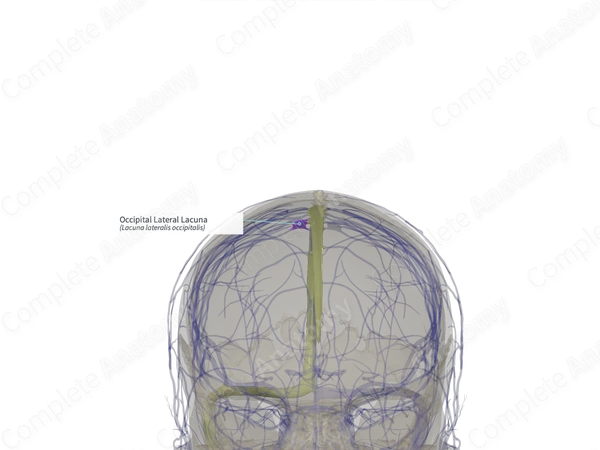 Occipital Lateral Lacuna (Right)