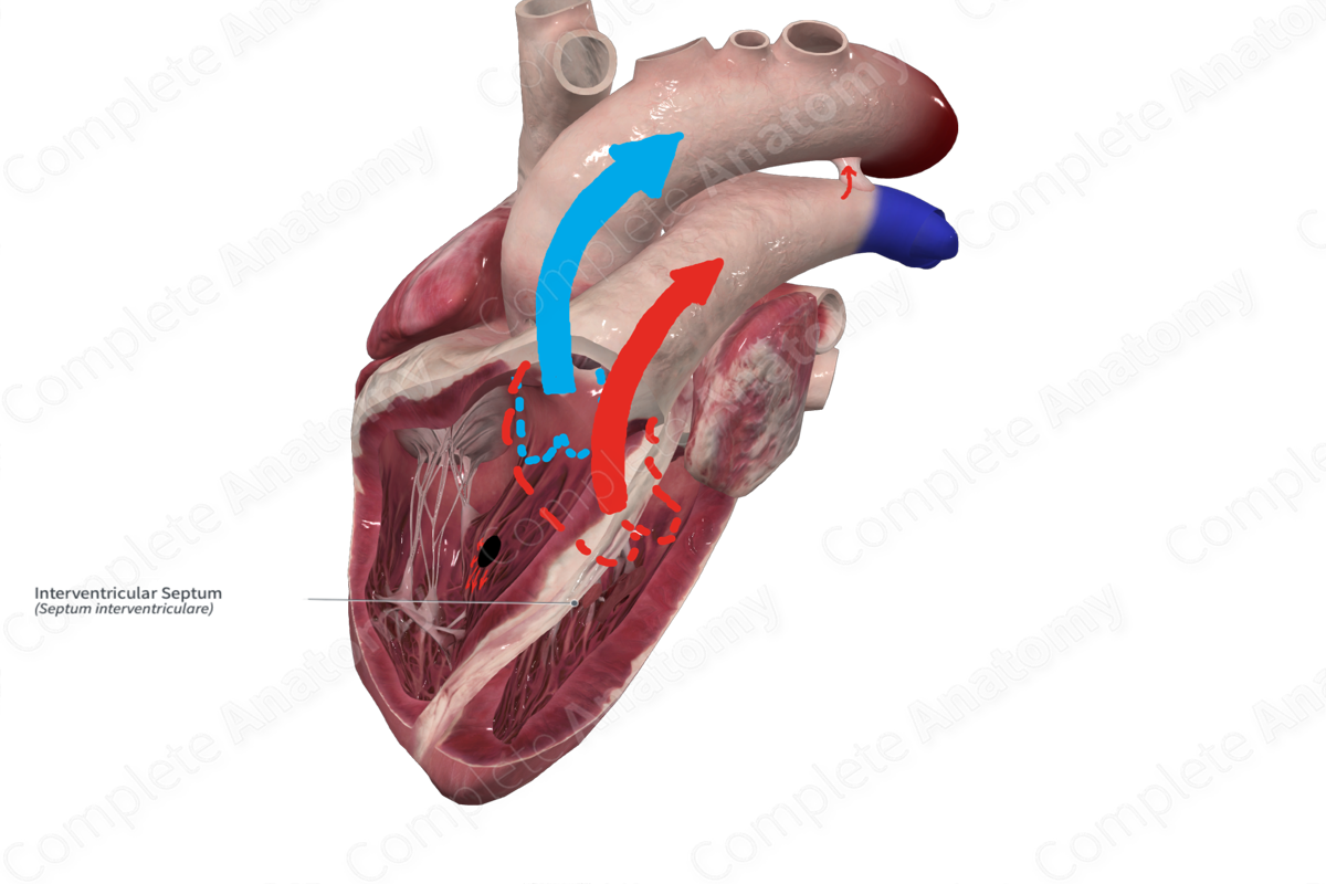 Interventricular Septum