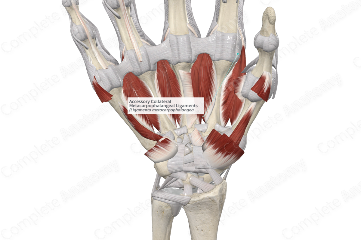 Accessory Collateral Metacarpophalangeal Ligaments 
