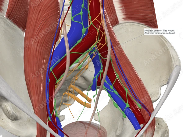 Medial Common Iliac Nodes