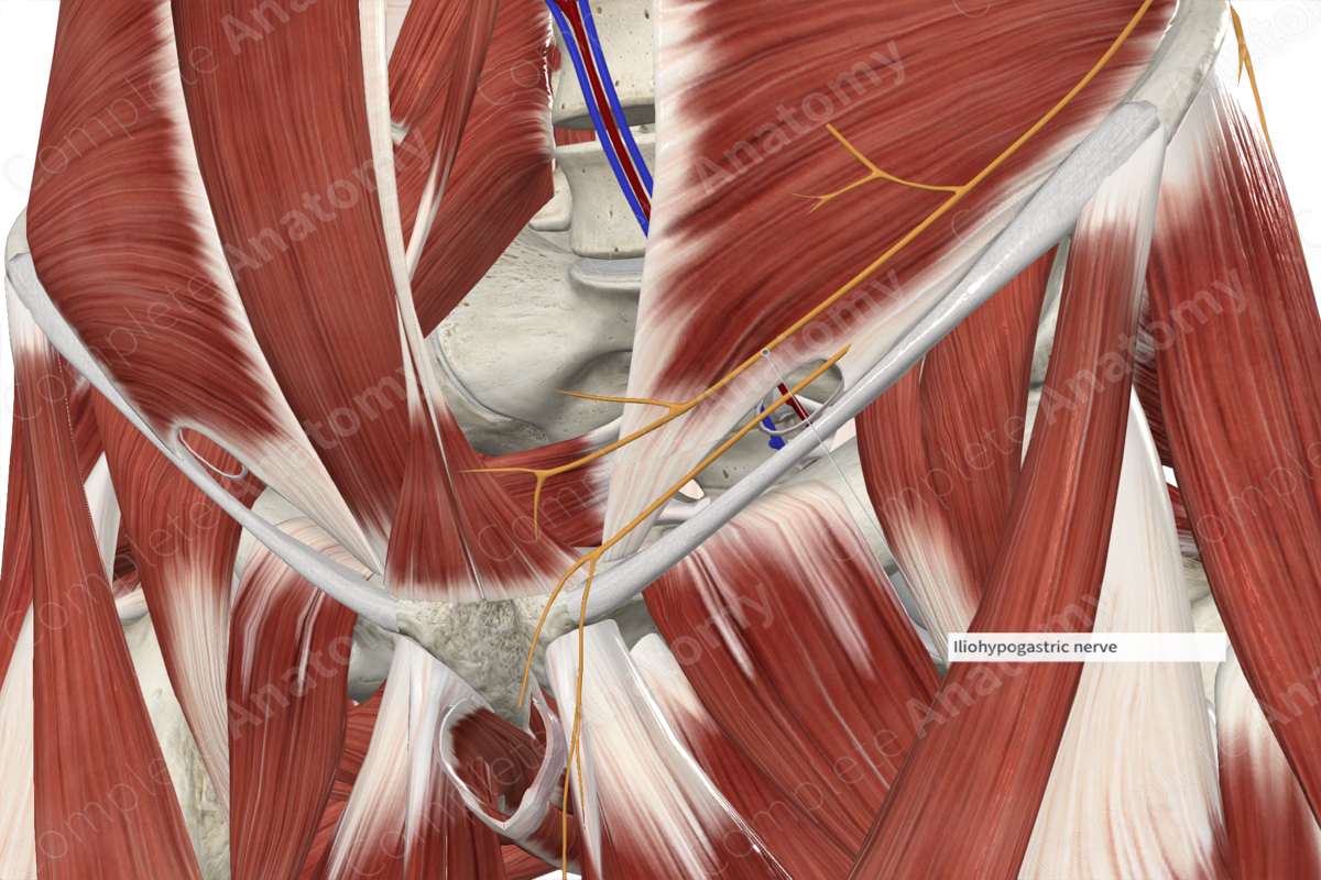 Anterior Cutaneous Branch of Iliohypogastric Nerve 