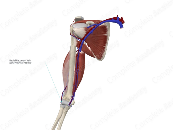 Radial Recurrent Vein