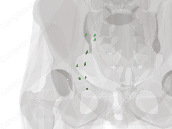 External Iliac Nodes (Left)
