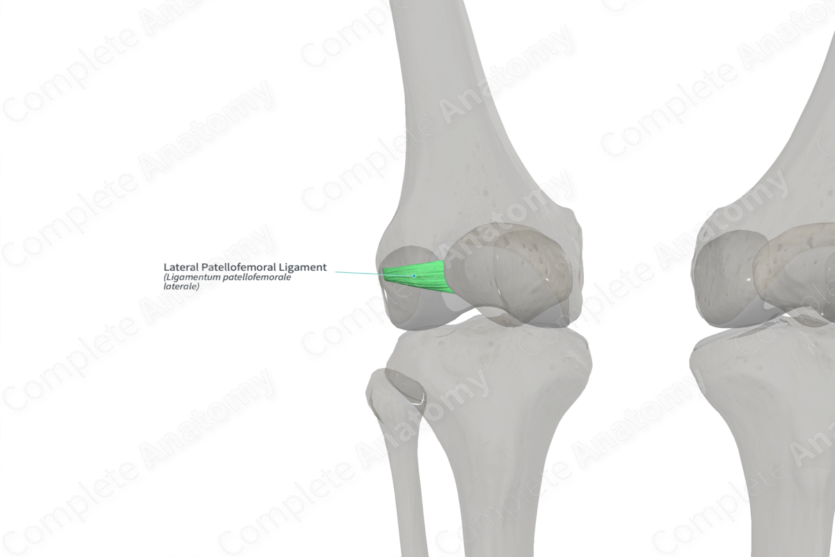 Lateral Patellofemoral Ligament (Right)