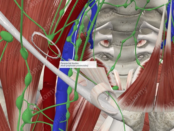 Pararectal Nodes