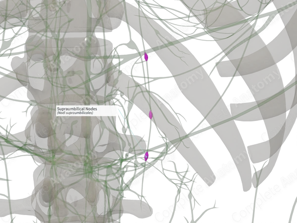 Supraumbilical Nodes (Left)