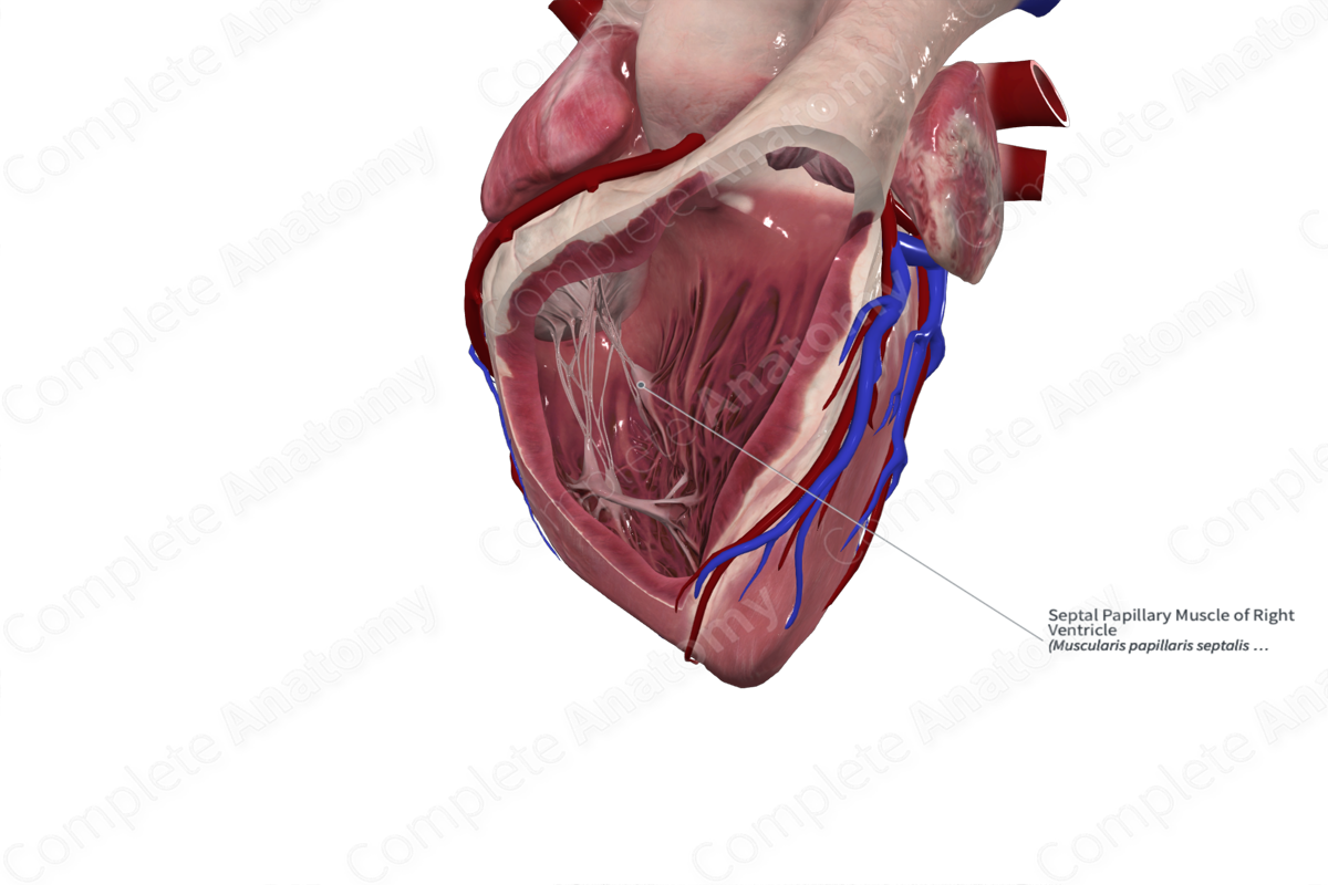Septal Papillary Muscle of Right Ventricle