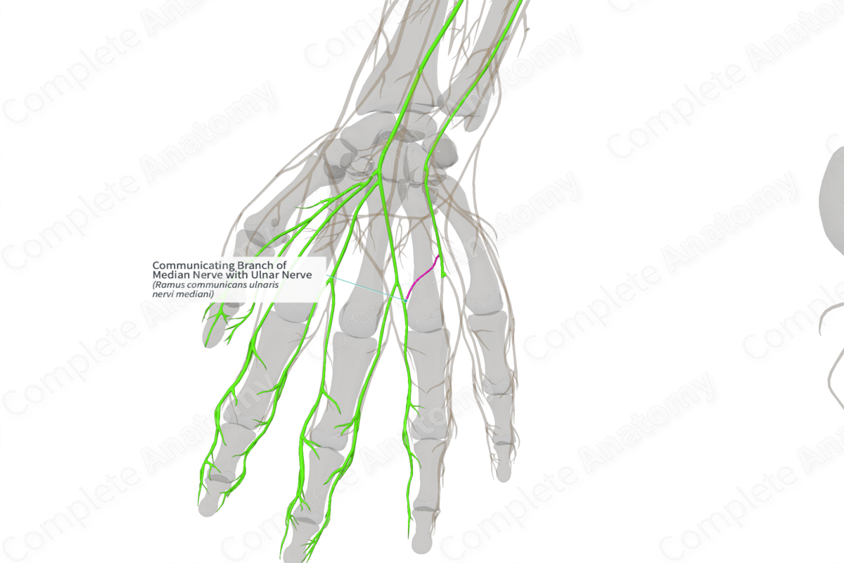 Communicating Branch of Median Nerve with Ulnar Nerve (Left)