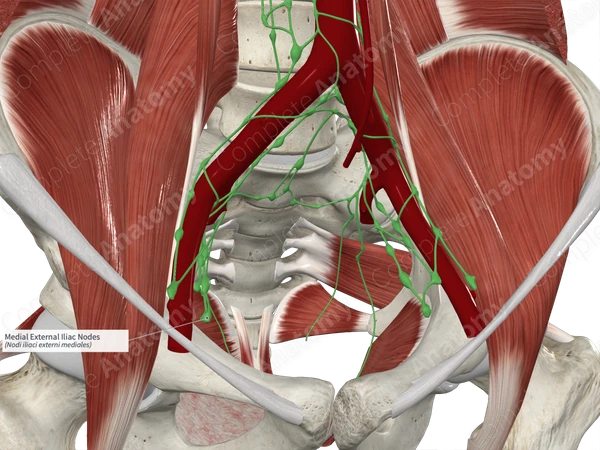 Medial External Iliac Nodes