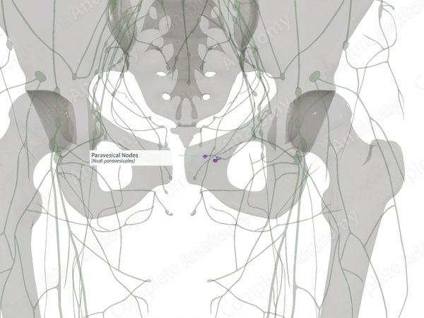 Paravesical Nodes (Left)