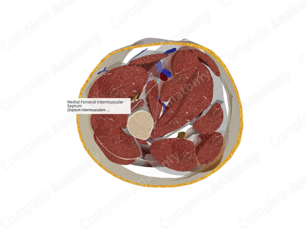 Medial Femoral Intermuscular Septum