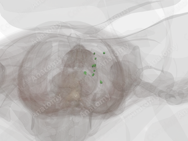 External Iliac Nodes (Left)
