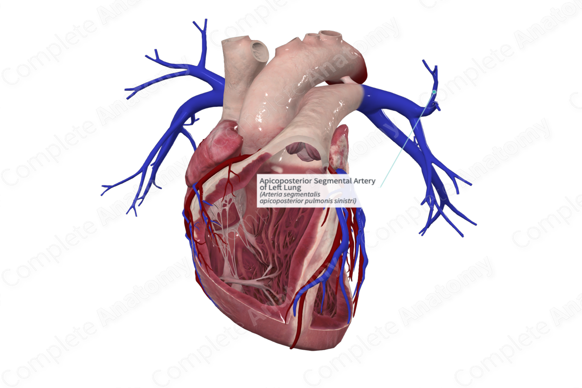Apicoposterior Segmental Artery of Left Lung