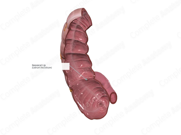 Ileocecal Lip