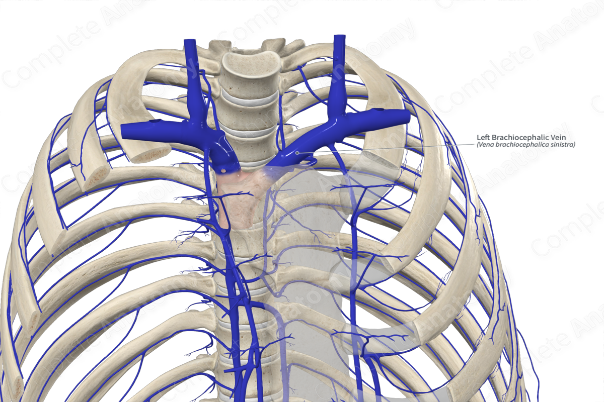 Left Brachiocephalic Vein