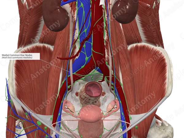 Medial Common Iliac Nodes
