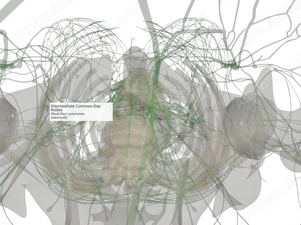 Intermediate Common Iliac Nodes (Right)