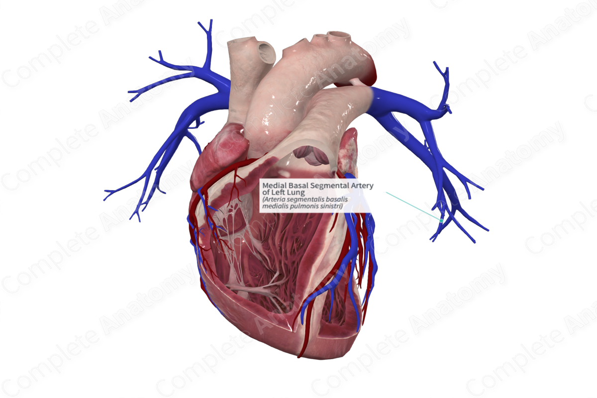 Medial Basal Segmental Artery of Left Lung