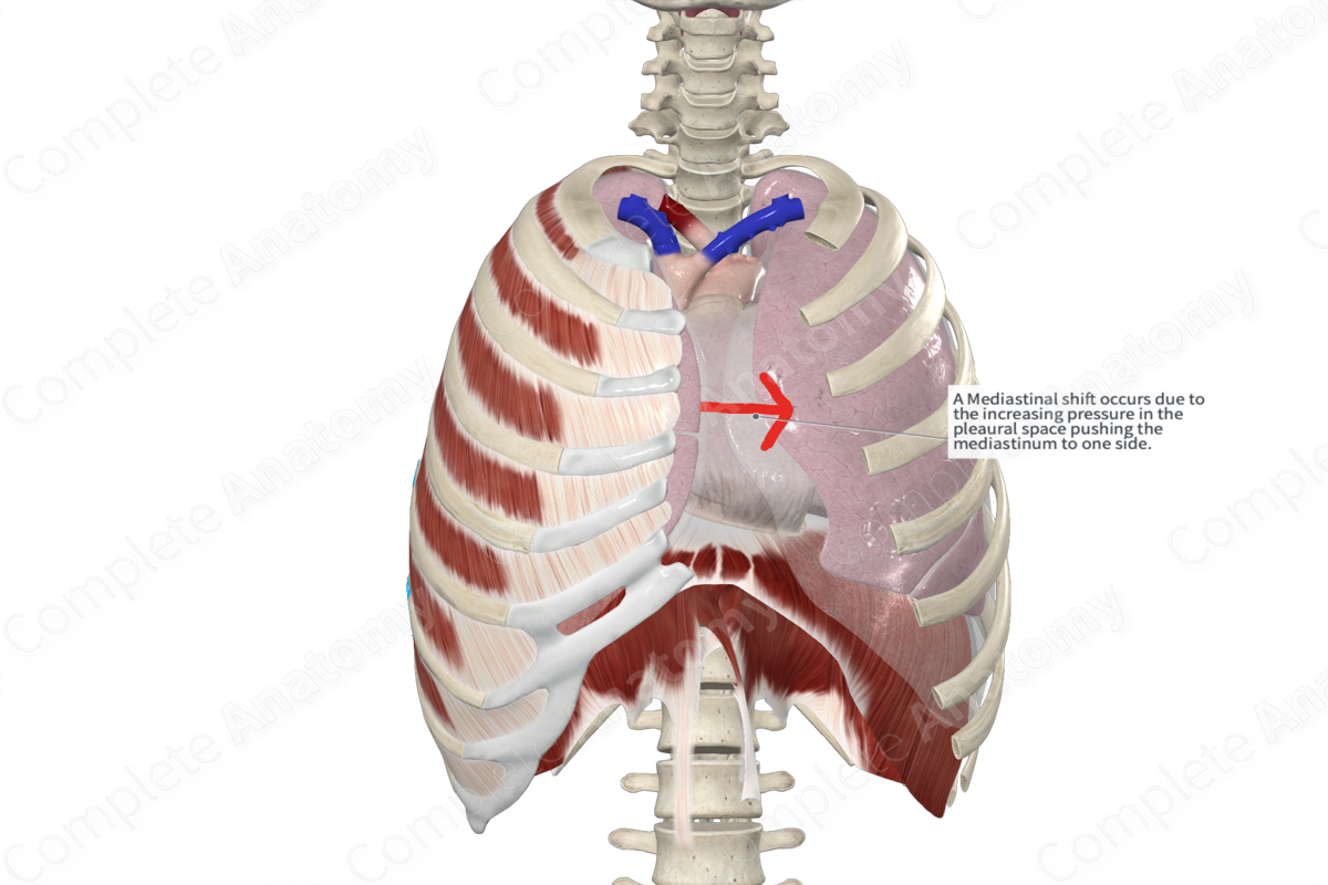 Costal Part of Pleura (Left Lung)