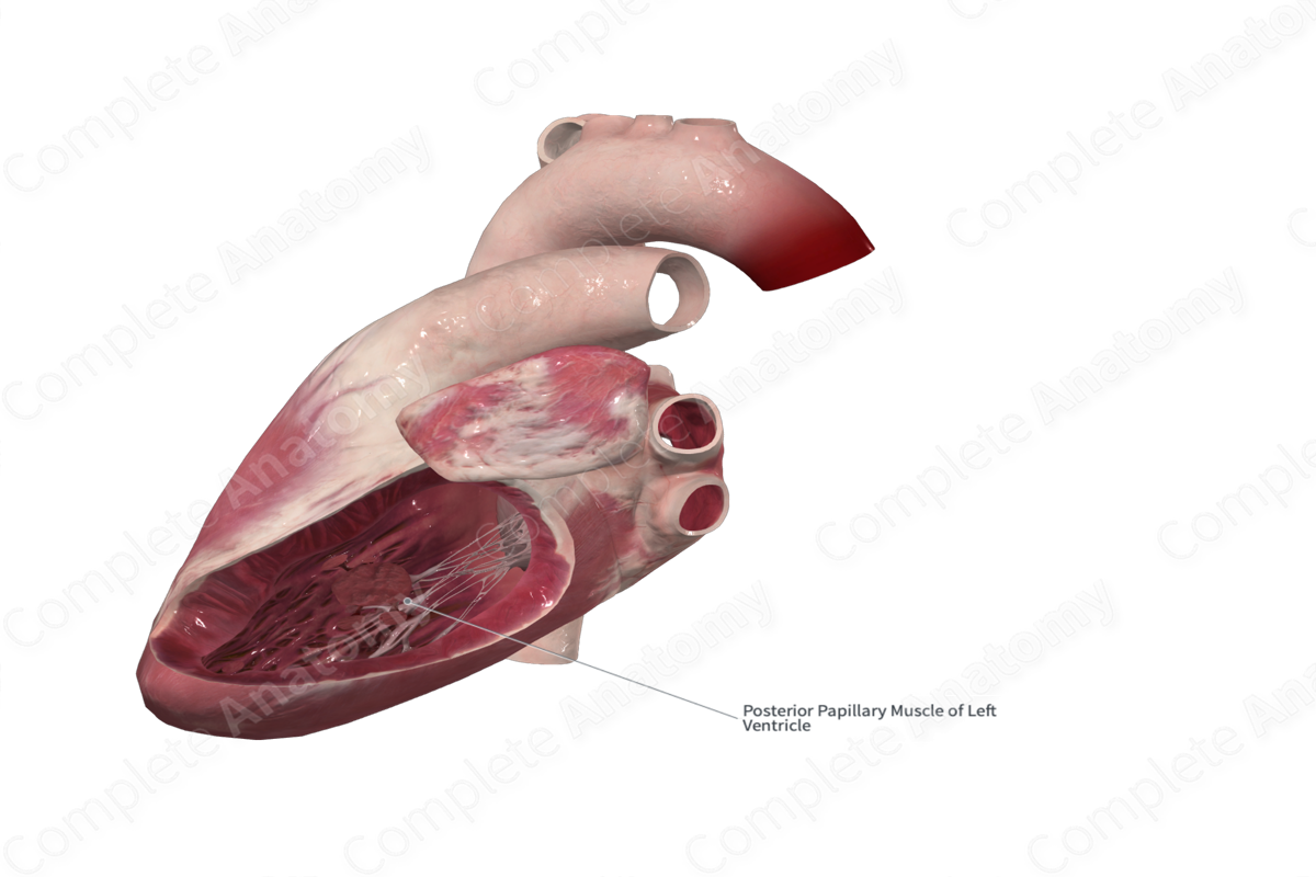 Inferior Papillary Muscle of Left Ventricle