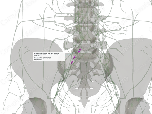 Intermediate Common Iliac Nodes (Right)
