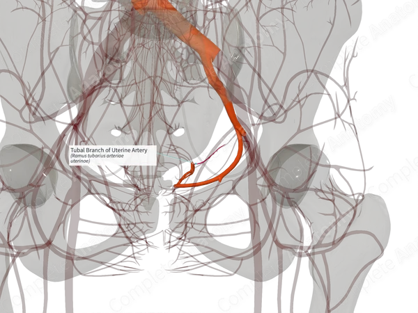 Tubal Branch of Uterine Artery (Left)