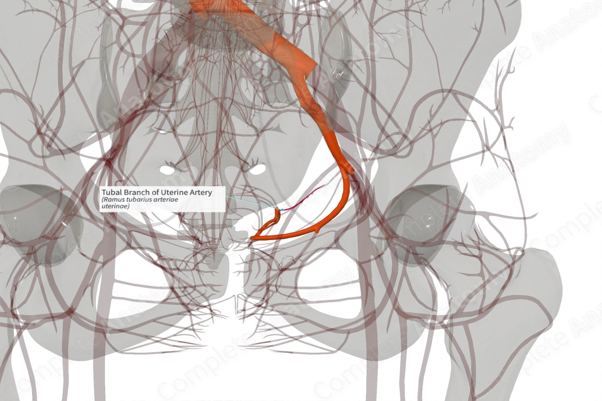Tubal Branch of Uterine Artery (Left)