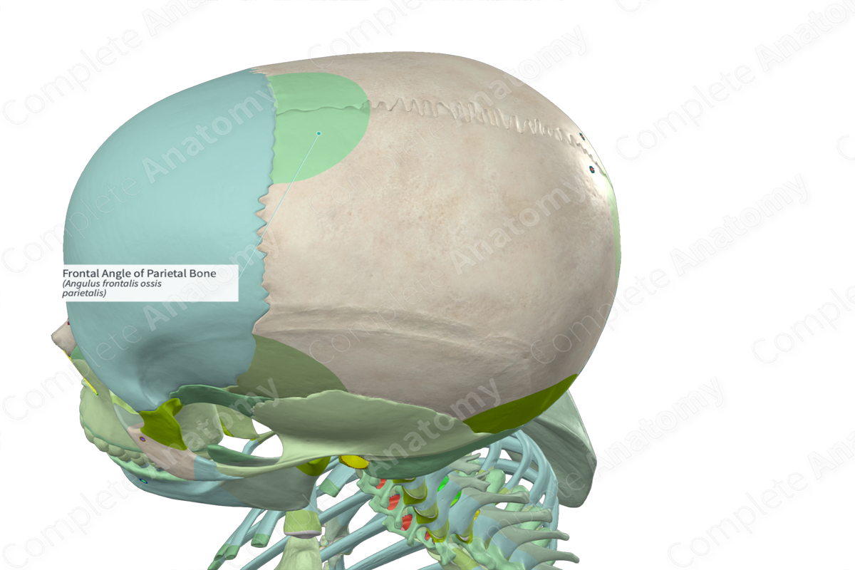 Frontal Angle of Parietal Bone