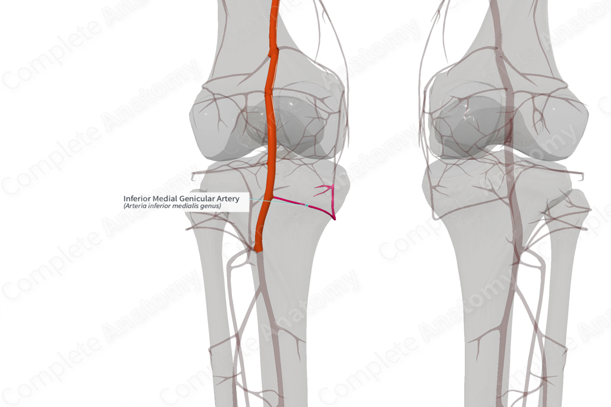 Inferior Medial Genicular Artery (Left)