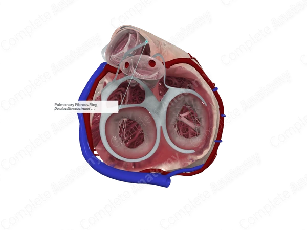 Pulmonary Fibrous Ring