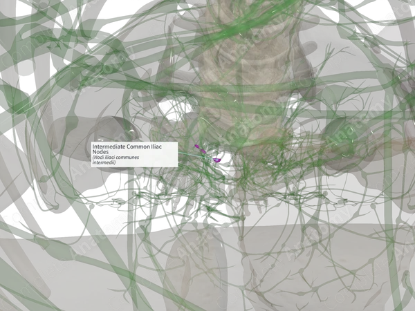 Intermediate Common Iliac Nodes (Right)