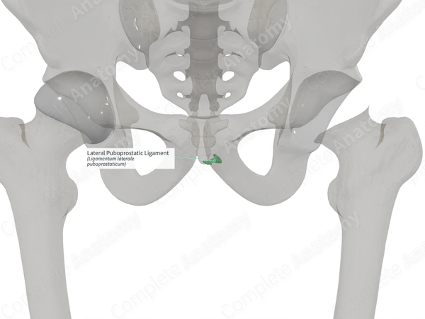Lateral Puboprostatic Ligament (Left)
