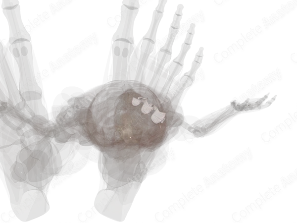 Intermetatarsal Joints (Left)