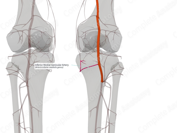 Inferior Medial Genicular Artery (Left)