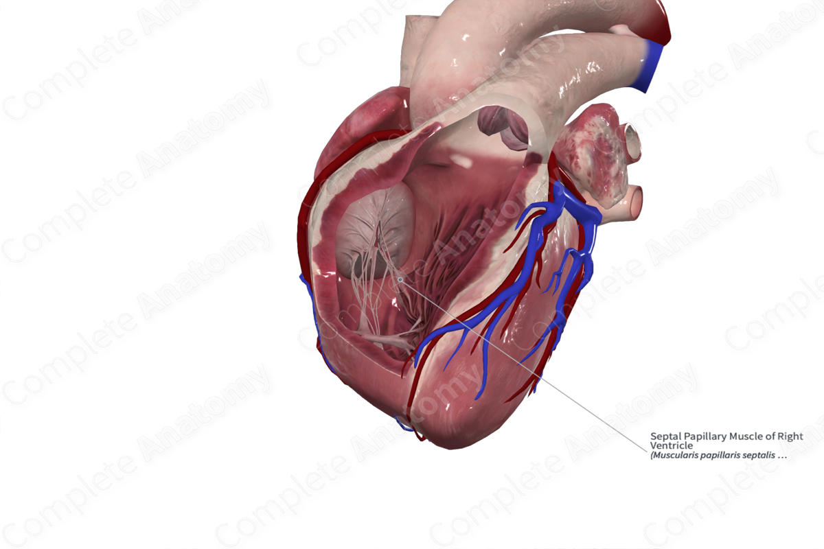 Septal Papillary Muscle of Right Ventricle