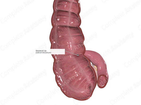 Ileocecal Lip