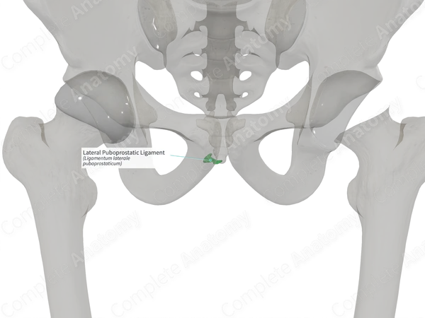 Lateral Puboprostatic Ligament (Left)