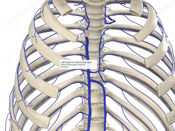 Left Superior Intercostal Vein