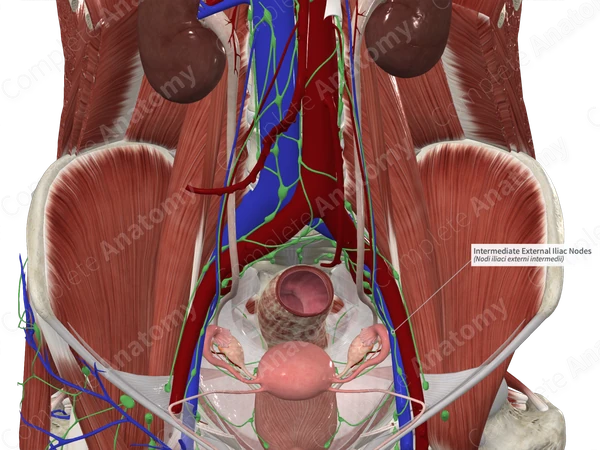 Intermediate External Iliac Nodes 
