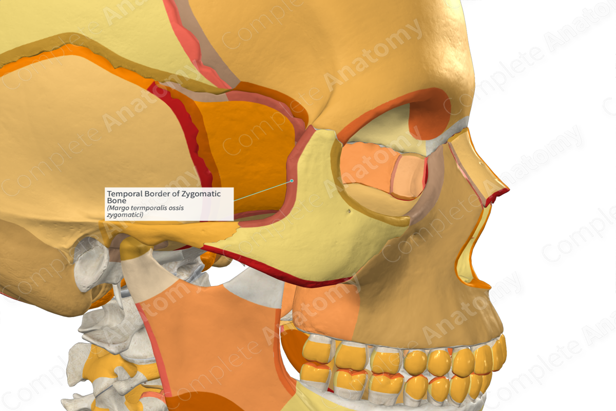 Temporal Border of Zygomatic Bone