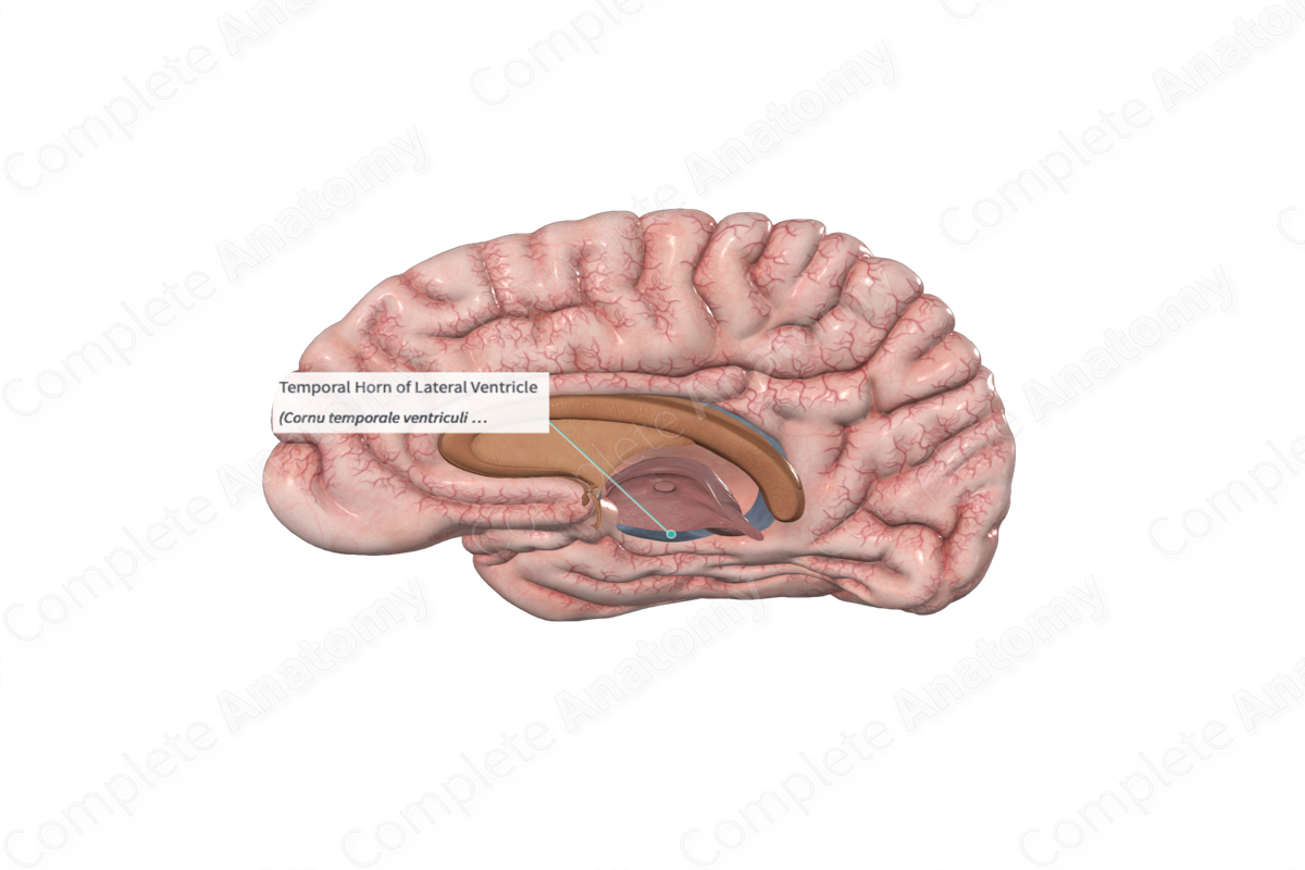 Temporal Horn of Lateral Ventricle 