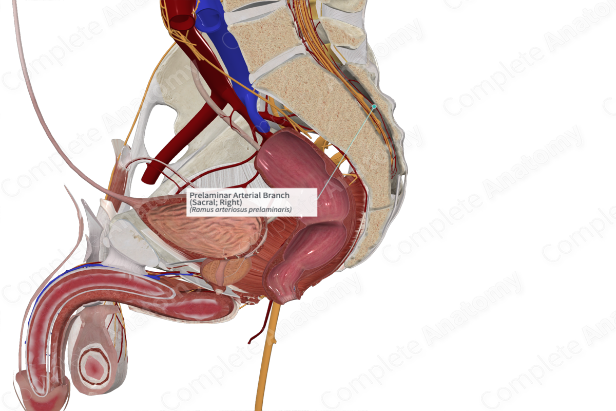 Prelaminar Arterial Branch (Sacral; Right)