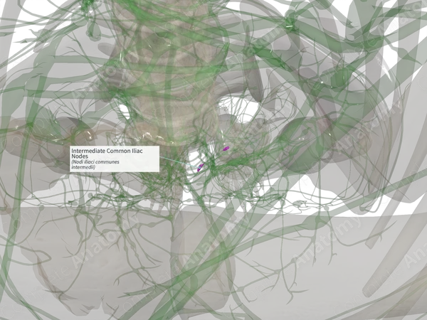Intermediate Common Iliac Nodes (Right)