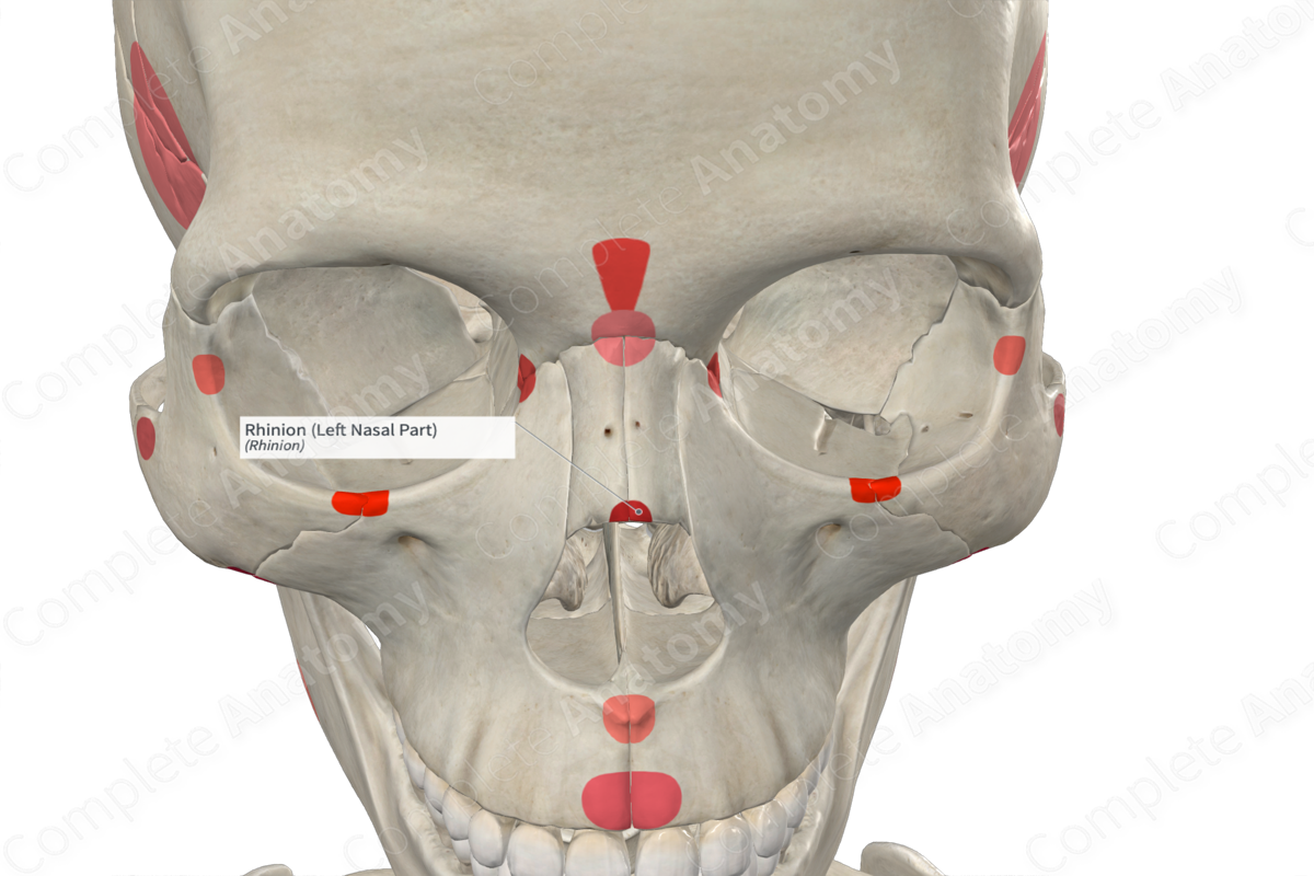 Rhinion (Left Nasal Part)