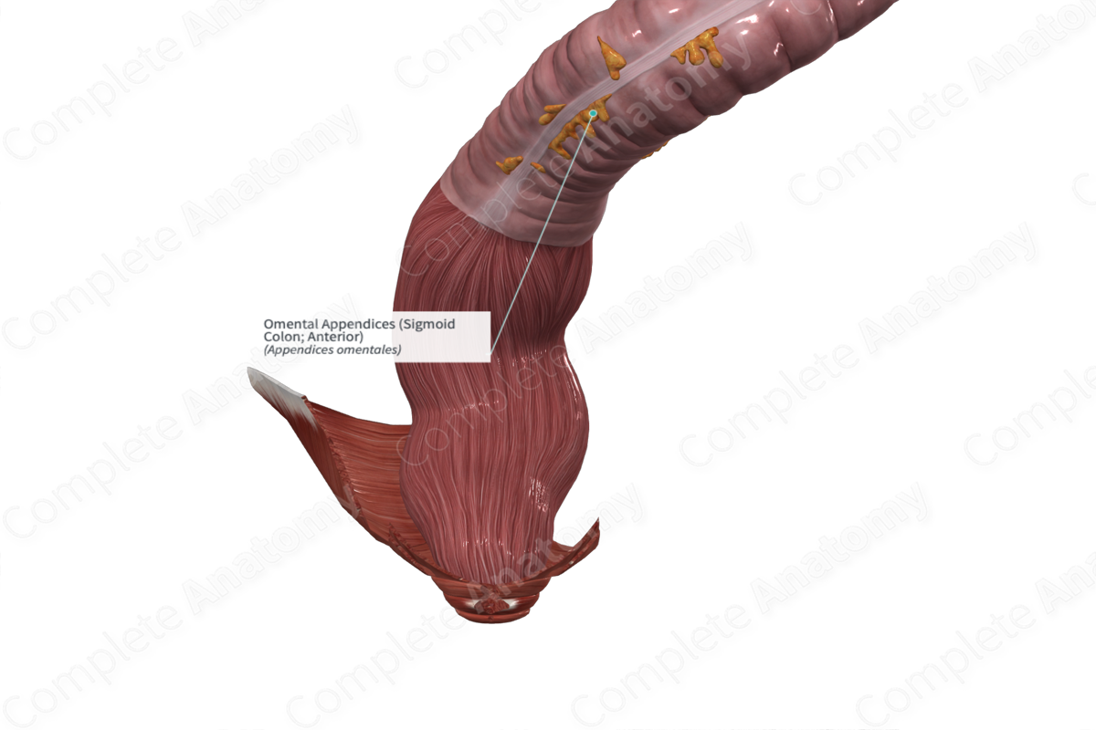 Omental Appendices (Sigmoid Colon; Anterior)