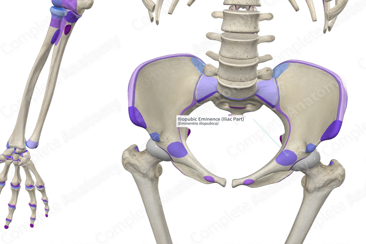 Iliopubic Eminence (Iliac Part)