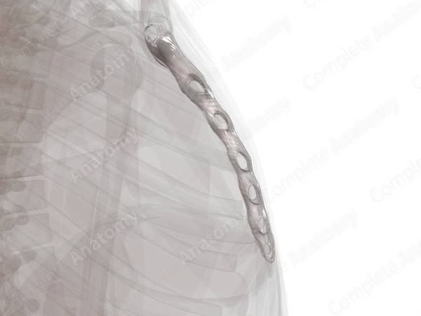 Sternochondral Joints