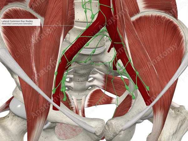 Lateral Common Iliac Nodes