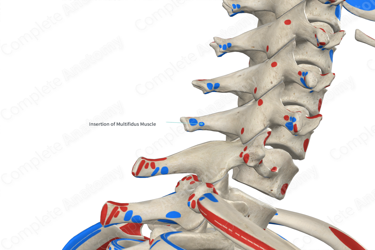 Insertion of Multifidus Muscle