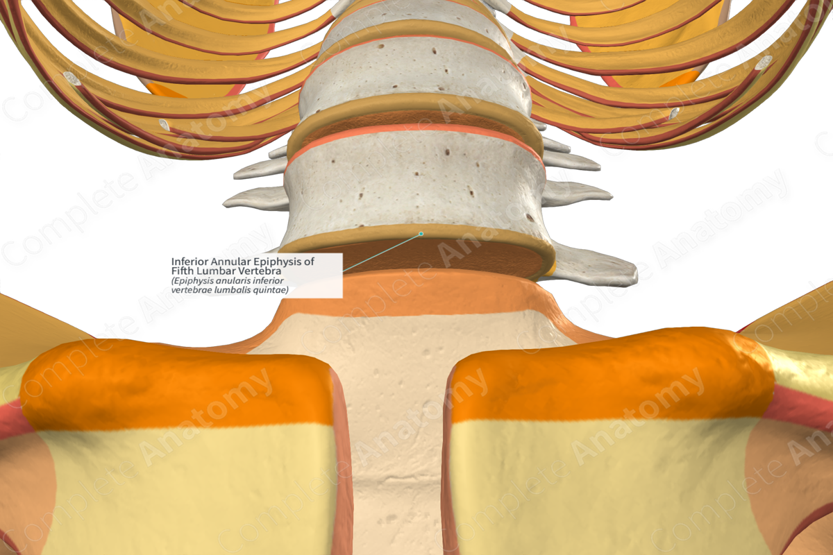 Inferior Annular Epiphysis of Fifth Lumbar Vertebra